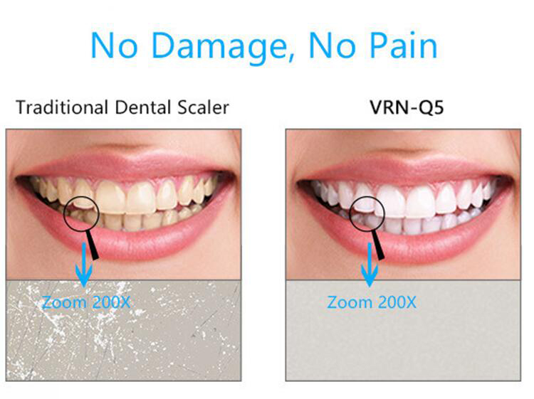 Periodontal Treatment Device